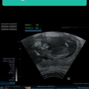 Meet your Posher, Joaquin